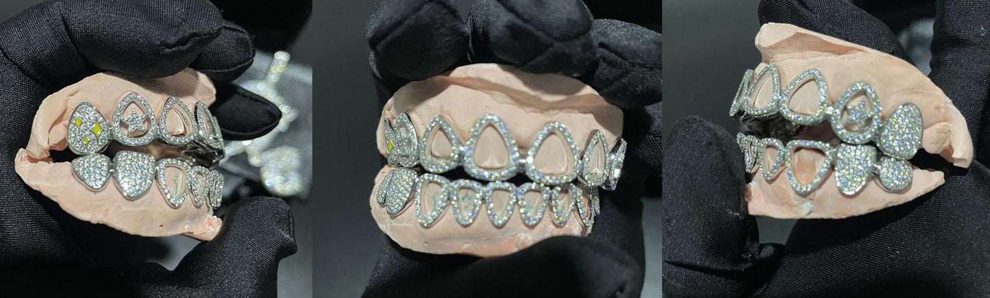 TG008 — Elegant Zigzag Moissanite Grillz - Top 2 & Bottom 8