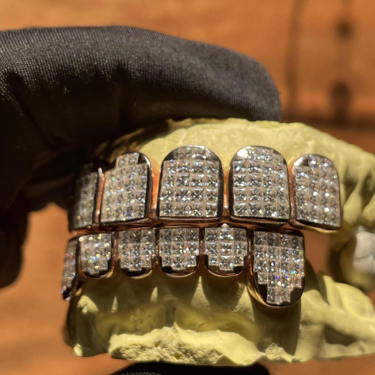 TG028 — Open Face Star Grillz S925 + Moissanite - Top 8 & Bottom 8