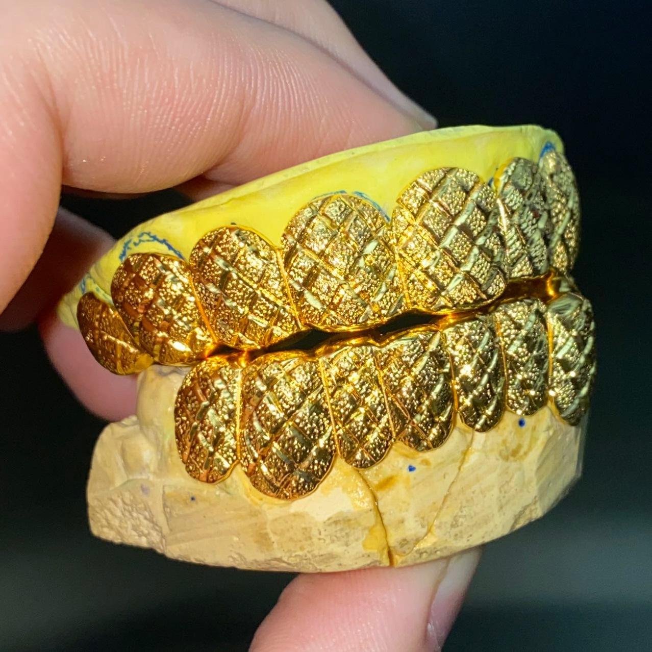 TG034 — Zigzag Setting Grillz S925 + Moissanite - Top 8 & Bottom 8