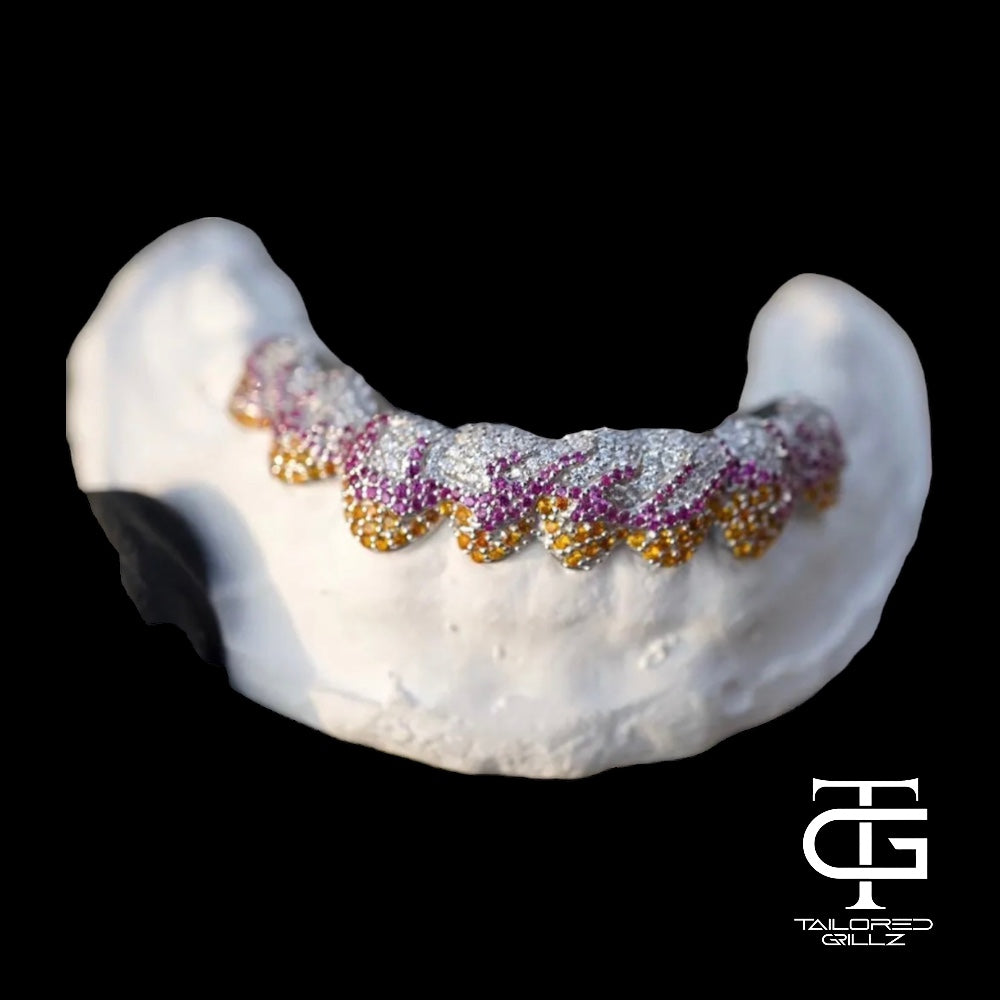 Custom Grillz Gold Teeth with Dripping Diamond dust