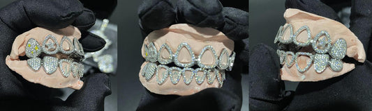TG008 — Elegant Zigzag Moissanite Grillz - Top 2 & Bottom 8