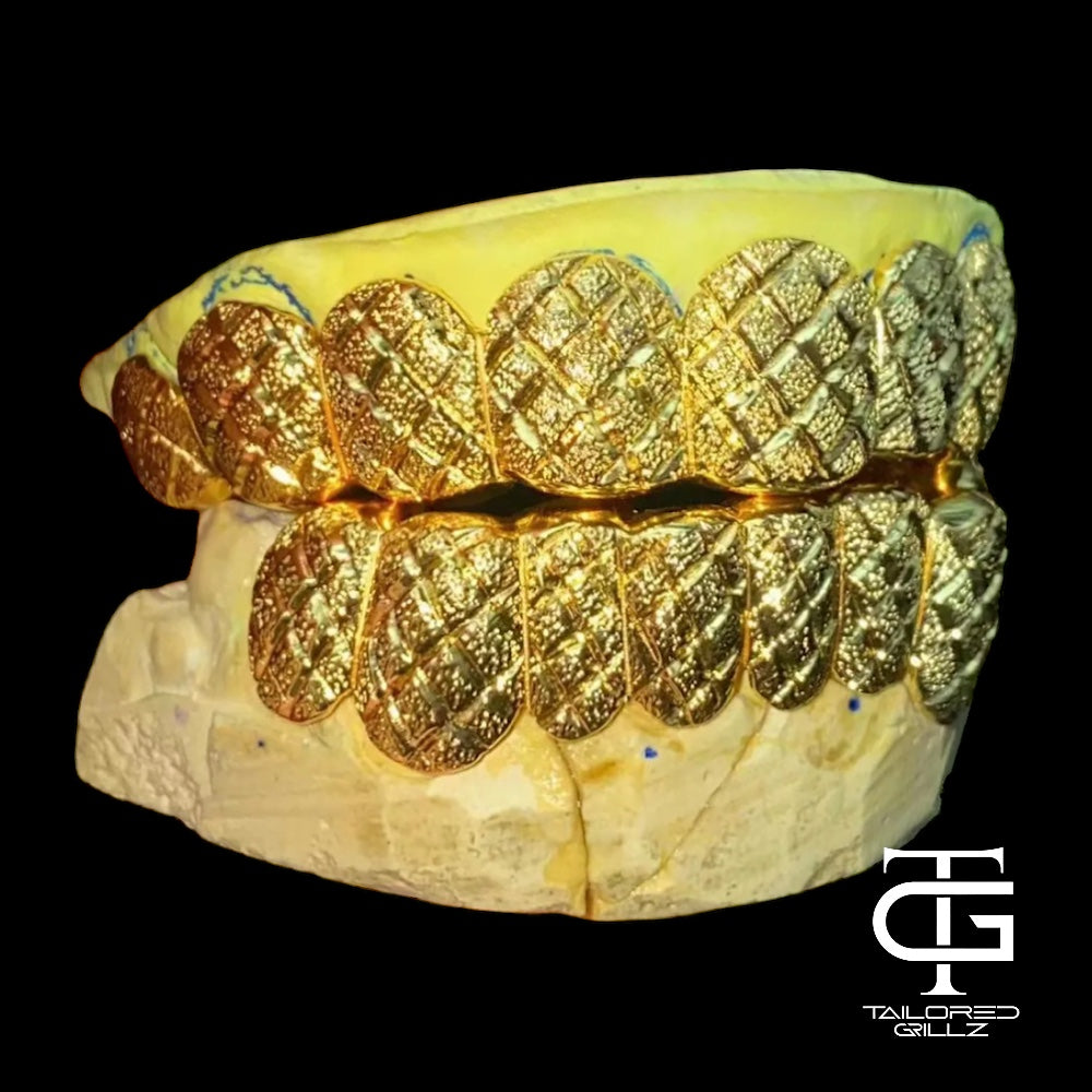 Gold Dust Grillz Set