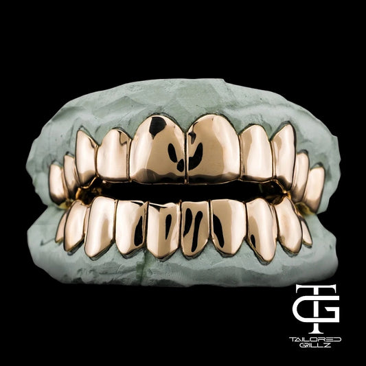 Standard Gold Grillz