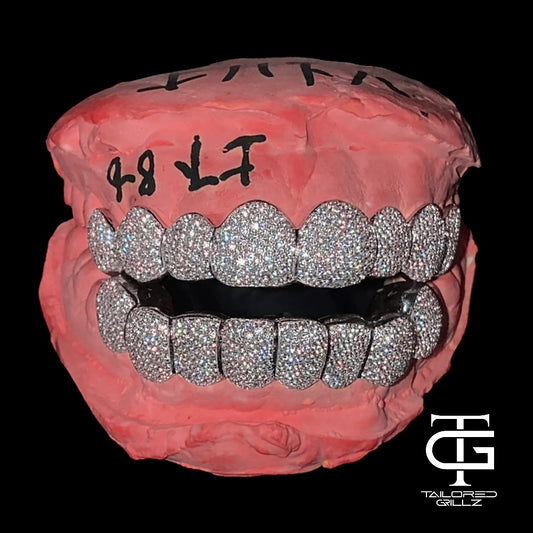 VVS Moissanite 16 Tooth Grillz Set